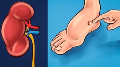 10 Sinais que seu corpo envia antes do derrame ocorrer