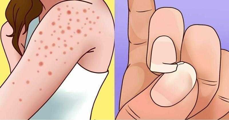 10 sinais graves da intolerância ao glúten