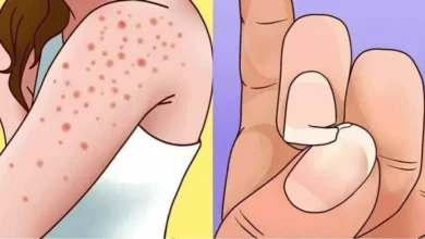 10 sinais graves da intolerância ao glúten