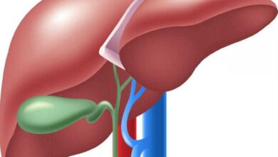 11 principais sintomas do câncer de vesícula