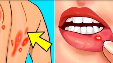 11 sintomas de HIV que nenhuma mulher pode em hipótese alguma ignorar.