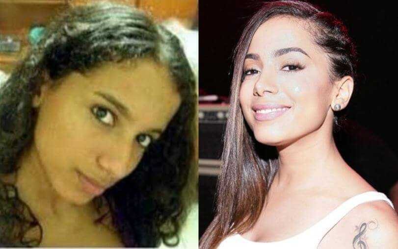 10 Famosos que melhoram com o tempo e o dinheiro