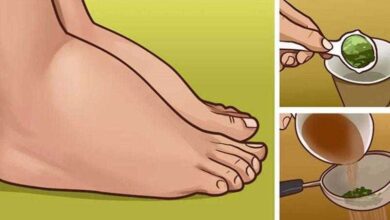 Melhor remédio caseiro para pernas inchadas