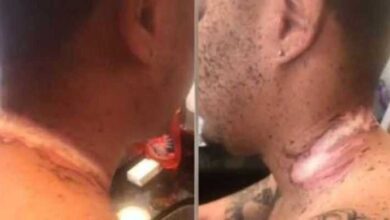 Homem dorme com seu celular carregando e quase morre após receber choque