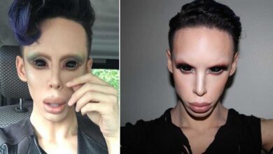 Rapaz gasta R$ 152 mil em cirurgias para se tornar um “alienígena assexual”