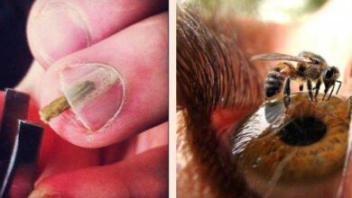 7 Imagens perturbadoras que vão chocar você