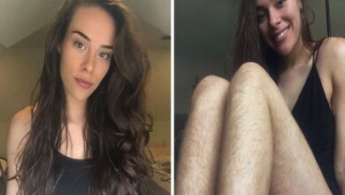 Garota não se depilou durante um ano, veja o resultado