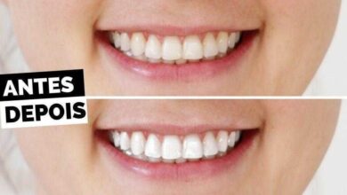 5 Maneiras caseiras para você branquear seus dentes