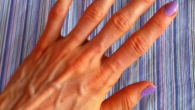 Saiba por que algumas pessoas têm as veias das mãos marcadas