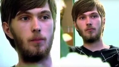 Rapaz fica 20 anos sem escovar os dentes e resultado é assustador