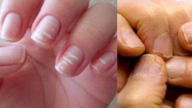 10 alertas que as suas unhas podem te mostrar