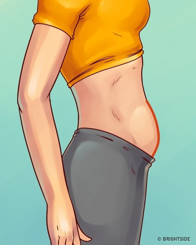 5 tipos de barriga que não são causados pelo excesso de peso 5 tipos de barriga que não são causados pelo excesso de peso