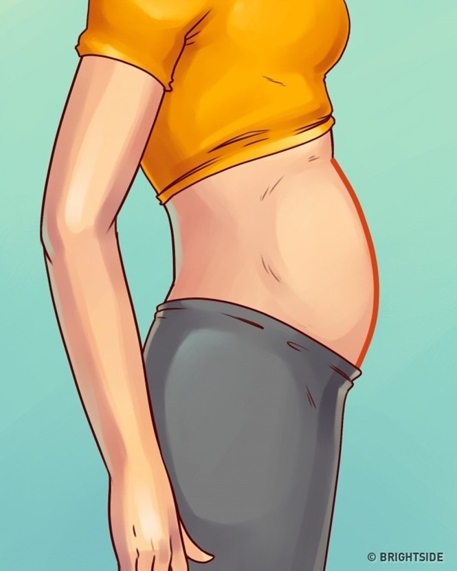 5 tipos de barriga que não são causados pelo excesso de peso 5 tipos de barriga que não são causados pelo excesso de peso
