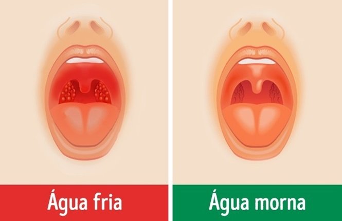 Foto: