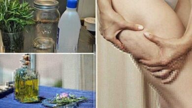 Como fazer álcool de Alecrim e elimine a gota, varizes, dor muscular e celulite d