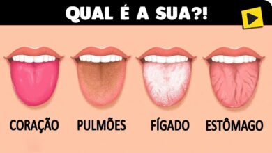 10 problemas revelados pela cor de sua língua