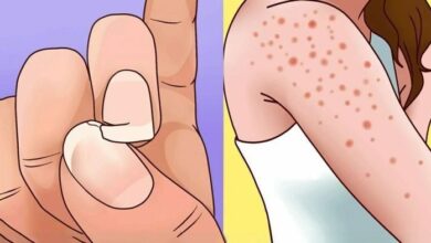 7 sinais de que você come muito açúcar e corre o risco de ter diabetes