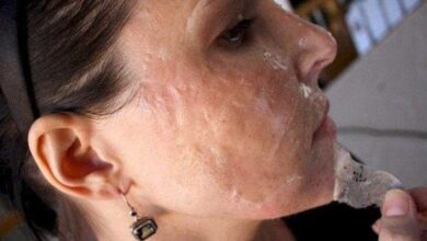 Como ACABAR com CRAVOS com apenas DOIS ingredientes