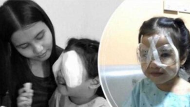 Filha perde visão por conta do uso de celular, e pai comove com relatos após milagre acontecer