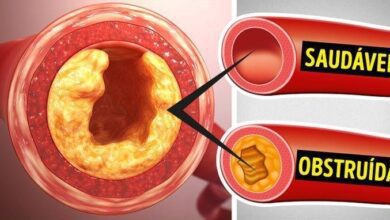 10 alimentos para você desentupir as artérias, normalizar a pressão e perder peso