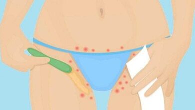 Como evitar pelos encravados na depilação com lâmina d