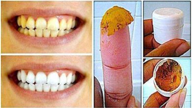 Dentes mais brancos com apenas 2 ingredientes 1