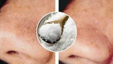 Como usar o sal contra cravos e espinhas