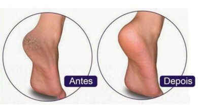 Receita para acabar com as rachaduras nos pés e mante-los macios