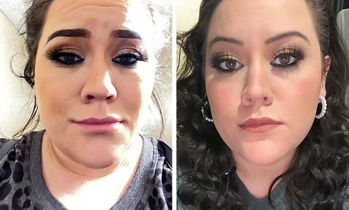 5 Exercícios para eliminar dores nos joelhos e pernas