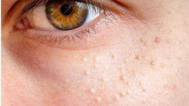 Sabe o que podem ser esses pontos brancos na cara?