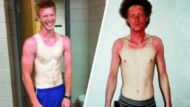 17 Pessoas que esqueceram o quanto as marcas de sol podem ser constrangedoras