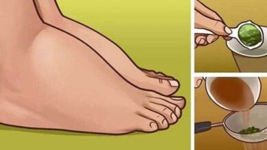 Excelente remédio caseiro para pernas inchadas 2