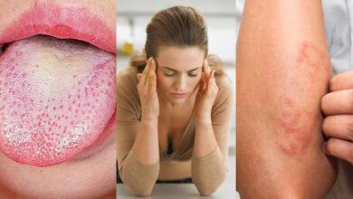 9 Sinais de que seu corpo está com excesso de toxinas