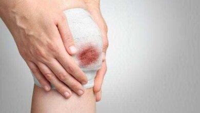 3 plantas para curar e cicatrizar feridas