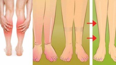 10 Tratamentos naturais para pernas inchadas