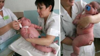 Bebê nasce com 18 kg e bate o recorde de maior bebê do mundo