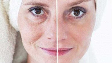 Tratamentos caseiros para as manchas na pele