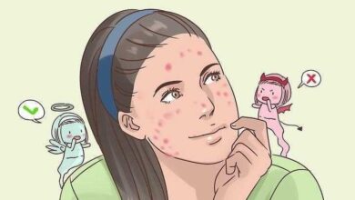 7 hábitos que dão muita acne e você nem imaginava