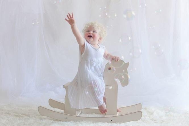 12 fotos que mostram a beleza cativante de pessoas albinas