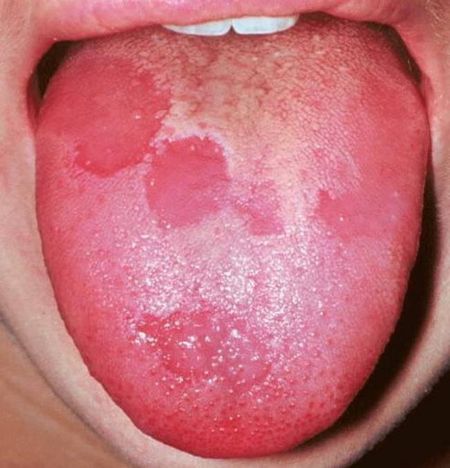 Saude-Lingua-3