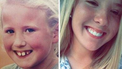 20 transformações quase inacreditáveis de pessoas que tinham dentes fora do lugar