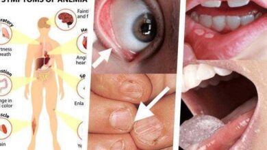 Conheça 8 sinais de alerta de anemia