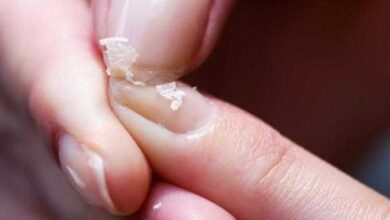 10 coisas erradas que você faz e deixa suas unhas fracas e quebradiças