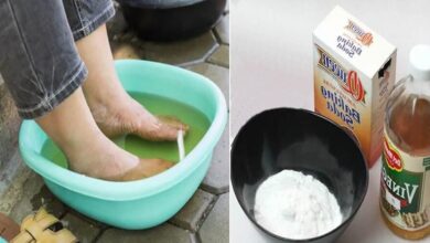 3 Receitas caseiras para eliminar fungos e tratar infecções