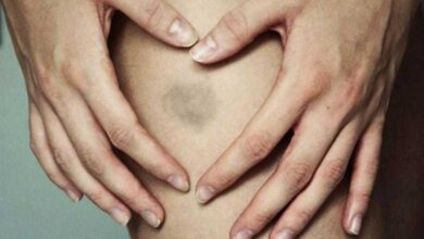 Roxo na pele do nada pode ser um alerta