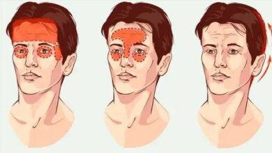 Como diferenciar uma enxaqueca de uma dor de cabeça emocional