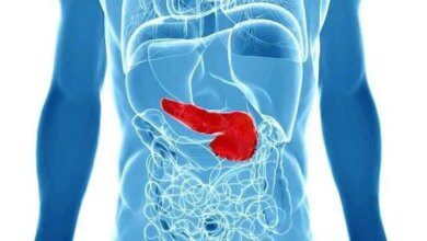 5 sintomas para detectar o câncer de pâncreas