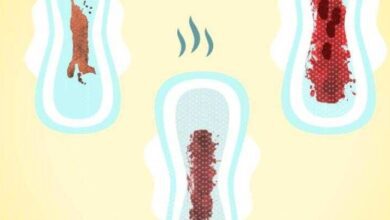 12 tipos de menstruação e o que eles dizem sobre sua saúde