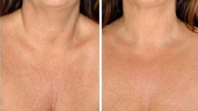 Receitas caseiras para cuidar da pele do pescoço