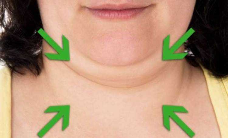 5 maneiras de eliminar a gordura da papada ou queixo duplo